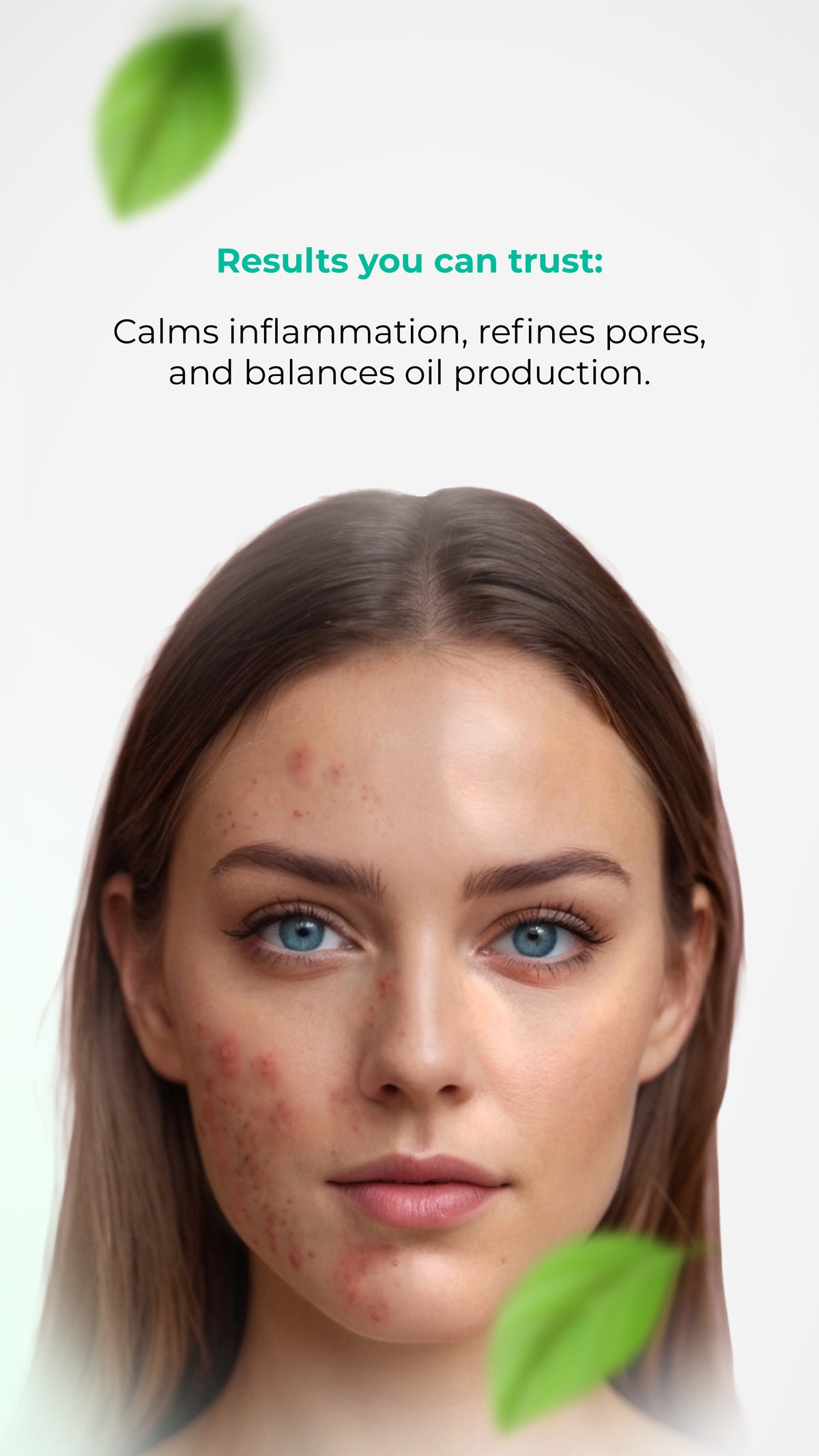 BIOACTIVE PEEL