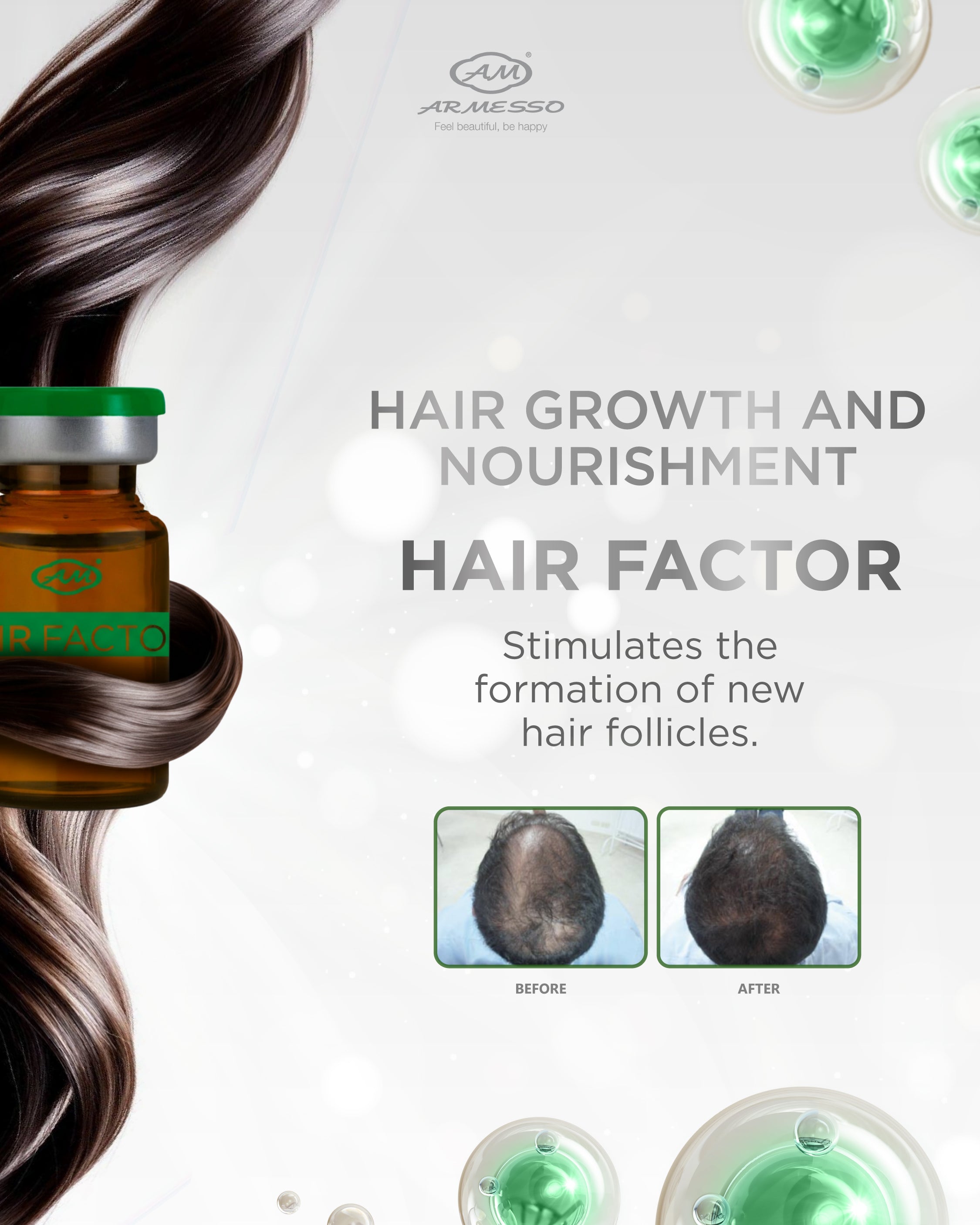 Armesso – Factor Capilar A.M.