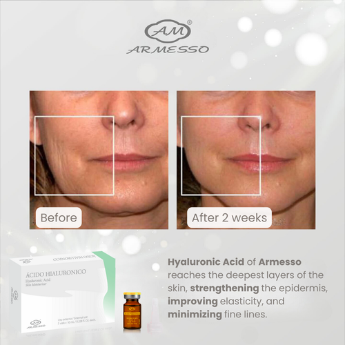 Armesso – A.M. Ácido Hialurónico
